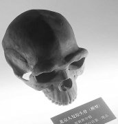 �ձ��ϱ�����͸���ܣ�������ͷ�ǹǲ��ڱ�������